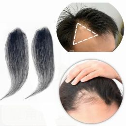 Toppers Petite ligne de cheveux humains naturels, patch de temple de remplacement, prothèse capillaire invisible, alopécie areata, postiche pour femmes et hommes