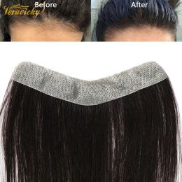 Toupees Invisible Hairline Frente Parche biológico del cuero cabelludo Piel PU con cintas Parche de cabello humano natural brasileño para la calvicie Frontline