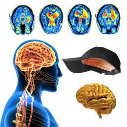 Stimulation cérébrale magnétique transcrânienne 1070 nm de réhabilitation infrarouge TPBM Casque de photobiomodulation