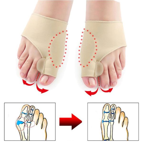 Tratamiento 1 separador de dedo del pie Hallux valgus bunion corrector martillo de punta dura