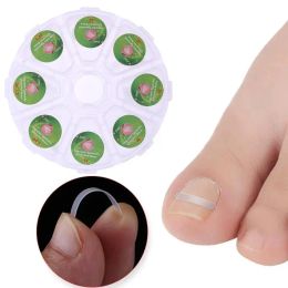 Traitements 100pcs Incarneux Toe Correction des ongles Correction Correcteur Correcteur Fichier Courbe élastique Courbe Conception conforme à l'ergonomie