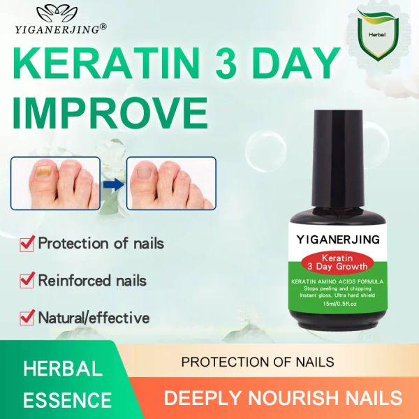 Traitements 2pcs Kératine Acides Acides Formule Nail Arrête Kératine Grow Growth Eleling and Cripping Nail Forcenener Réparation 15 ml Yiganerjing