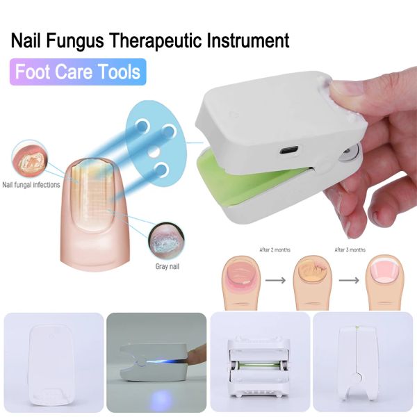 Tratamientos Dolor Fingernails Máquina de cura Mini Hongo de uñas Instrumento láser USB Cargo de silicona antislipio portátil para herramientas de cuidado de los pies