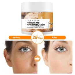 Turcuma Fabrial Skin Repair Cream Traitement de l'acné Visage Hydratant Whiterissage éclaircissant contre l'acné pour dissolver Crème
