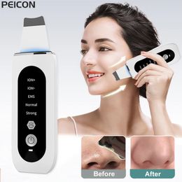 Ultrasonic Skin Scurbber Eleling Narhead Remover Face Nettoyage en profondeur Ion Ace Pore Cleaner Phelt Cleanser 240430