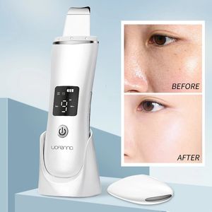 Ultrasone Huid Scrubber Pore Cleaner Ion Diepe Reiniging Mee-eter Dode Huid Remover Beauty Tool 240127