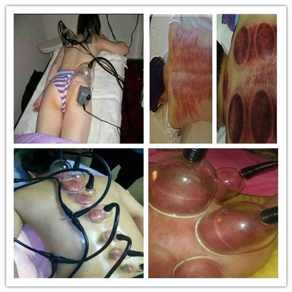 La forma del cuerpo agranda la máquina de masajeador de senos desnudos para mujeres con mejora de succión de senos