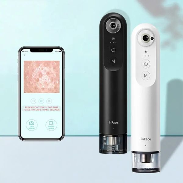 Dissolvant visuel de points noirs, nettoyage sous vide, acné, Microscope 5 mégapixels, caméra, beauté du visage, outil de soins de la peau, 240106