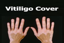 Vitiligo concealer vloeistof pen waterdichte vitiligo patches natuurlijk verbergen leukoderma instant make -up bedekkende oplossing voor huidziekte1253756