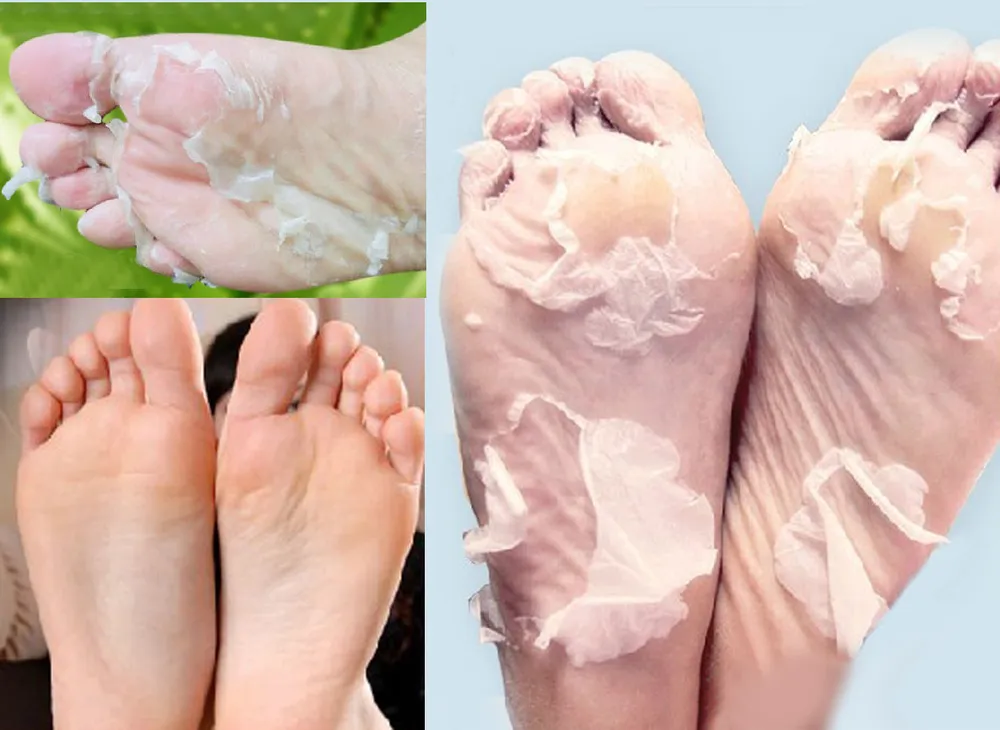 prix usine 1000 pièces 500 paires peau de pied lait lisse vinaigre de bambou enlever la peau morte exfoliant pieds masque pied enlever la vieille peau