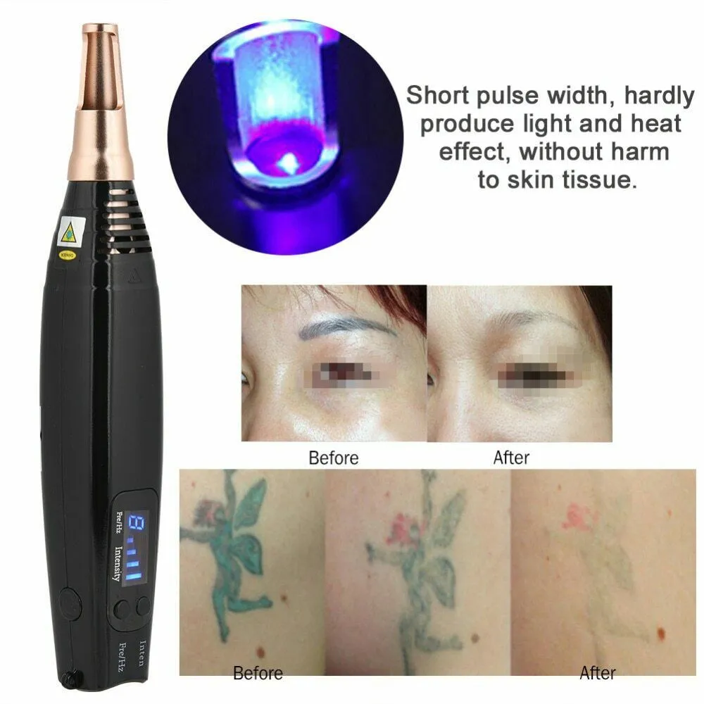 Ny uppgraderad Picosecond Pen II Blue Laser Tattoo Removal Pen Scer Spot Pigment Therapy Home Salon Spa Använd