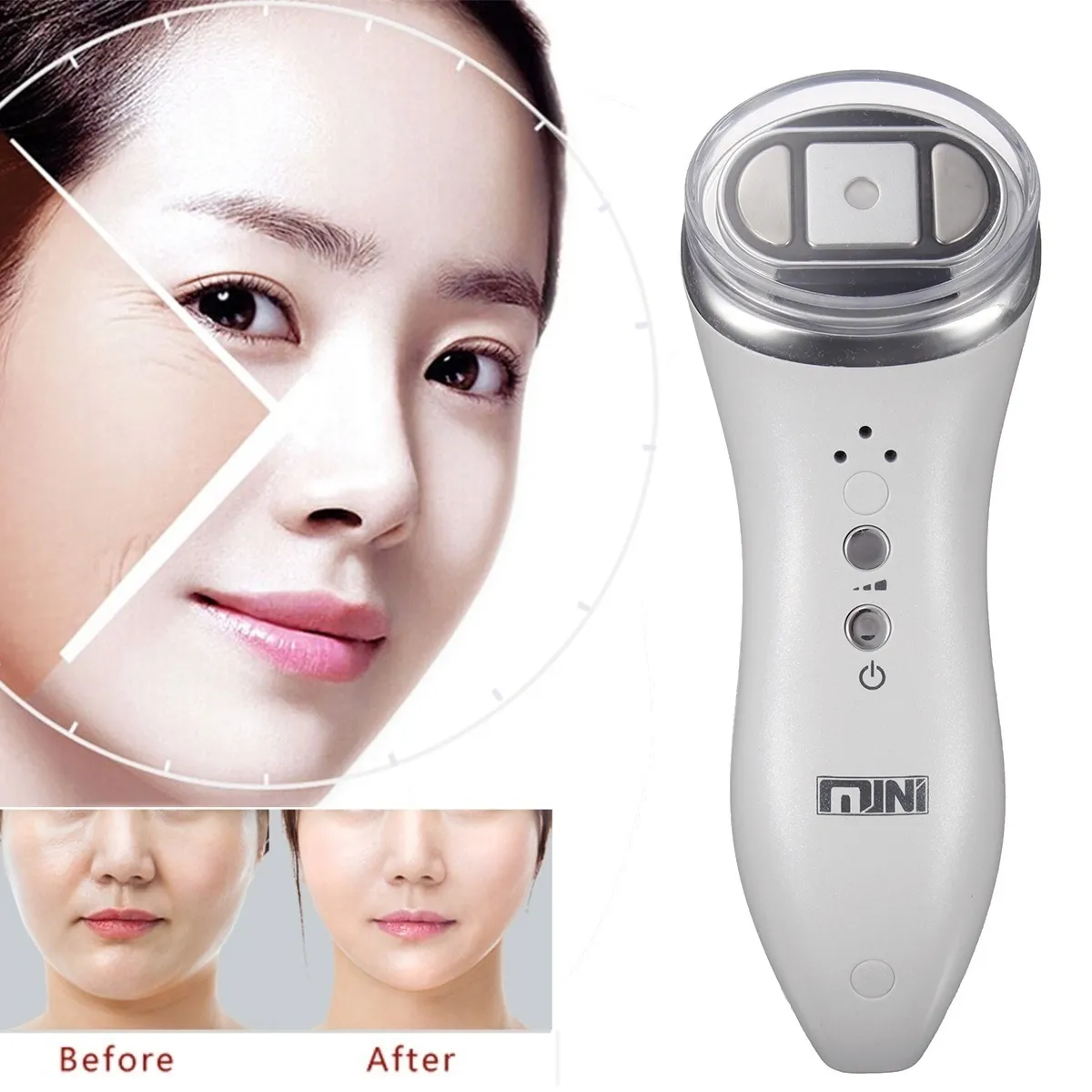 Ultrasuoni focalizzati Mini HIFU RF LED Ultrasuoni leggeri Anti-invecchiamento Cura della pelle del viso Stringere la macchina di bellezza per la rimozione delle rughe di sollevamento