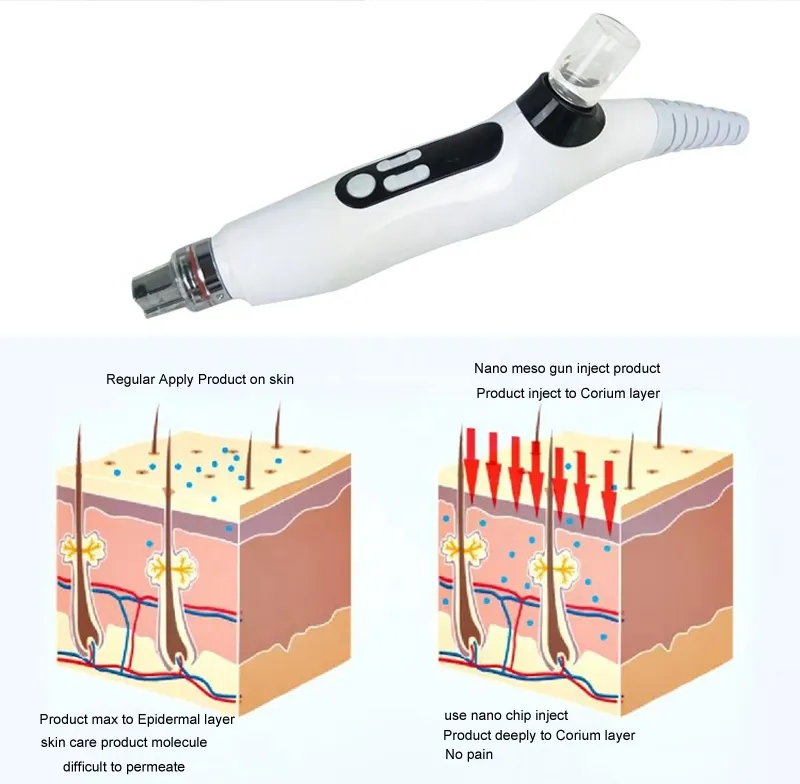 Portable Nano Mesogun Vacuum RF&EMS Mesotherapy Fractional Portable Nano Mesogun Vacuum RF&EMS Mesotherapy Fractional