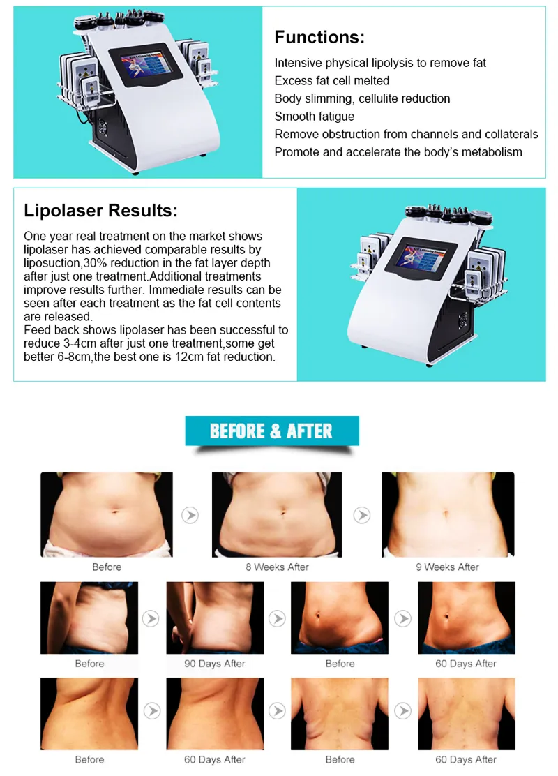 2019 Popüler 6-IN-140 K Ultrasonik Liposuction Hava Noktası 8-Pad Lazer Vakum RF Cilt Bakımı Salon Zayıflama Makinesi Güzellik Ekipmanları