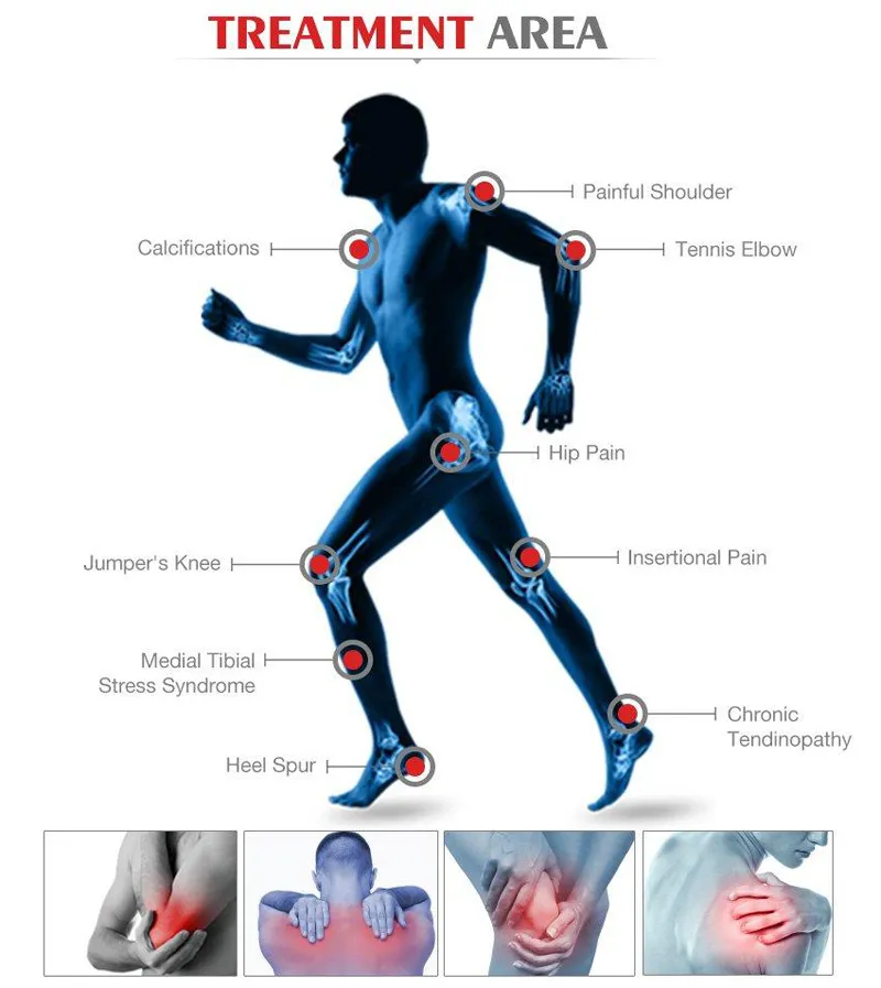 EMS elektronisk muskelstimulering fysioterapi utrustning för pojke smärtlindring / ESWT Shockwave Therapy Machine för ED-behandling