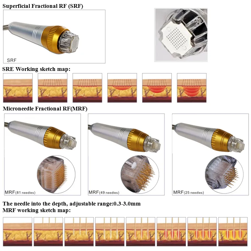 مقبض واحد مع 4 نصائح كسور rf ance إزالة microneedle rf الجلد تشديد وتمتد علامات إزالة معدات سبا