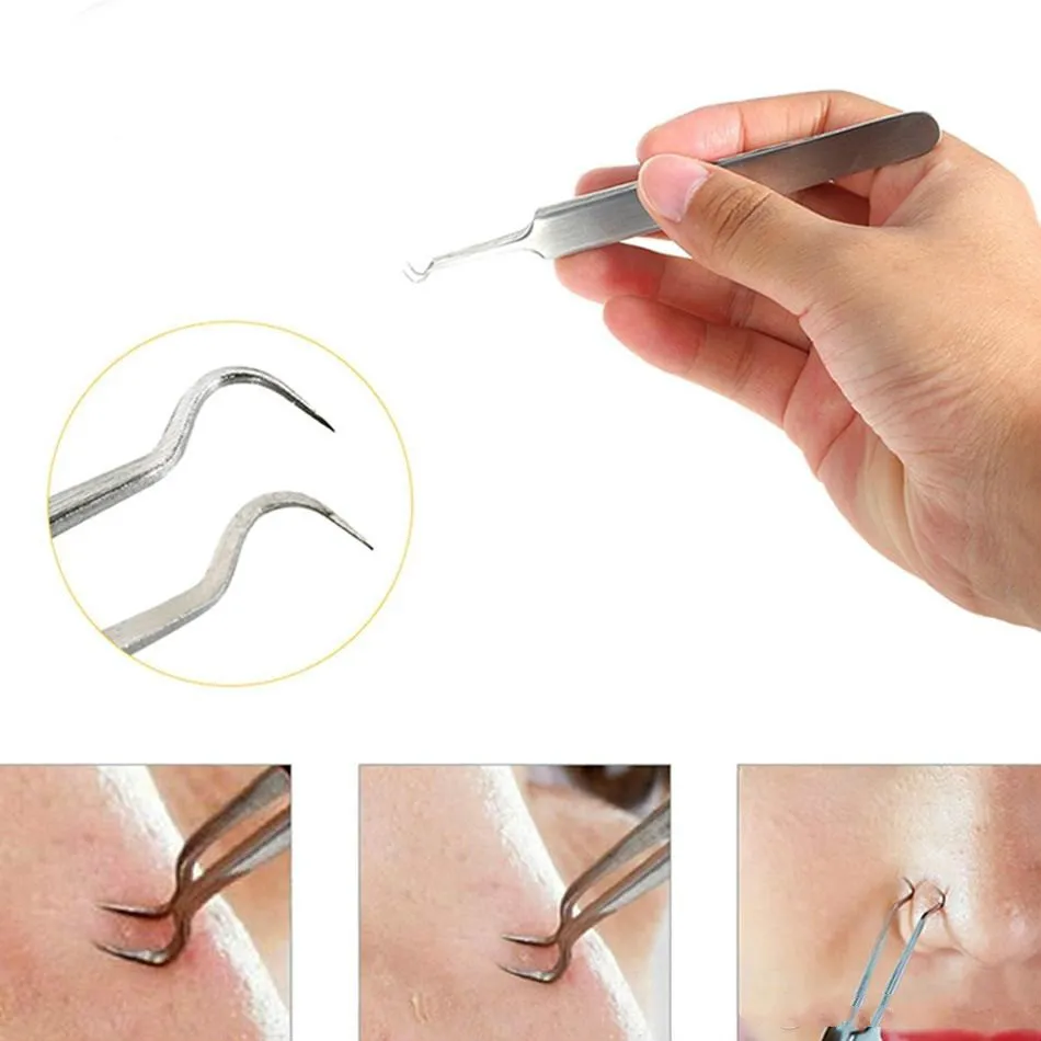 Roestvrijstalen Acne Naald Blackhead Removal Needle Pincet Removeor de Acné Face Care Beauty Repair Clip Acne Remover Tool