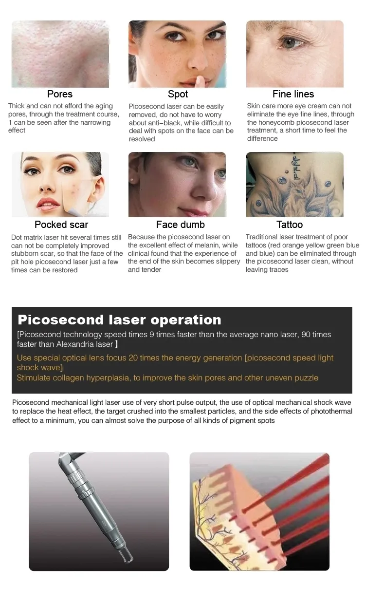 2022 New product laser tattoo removal picosecond machine