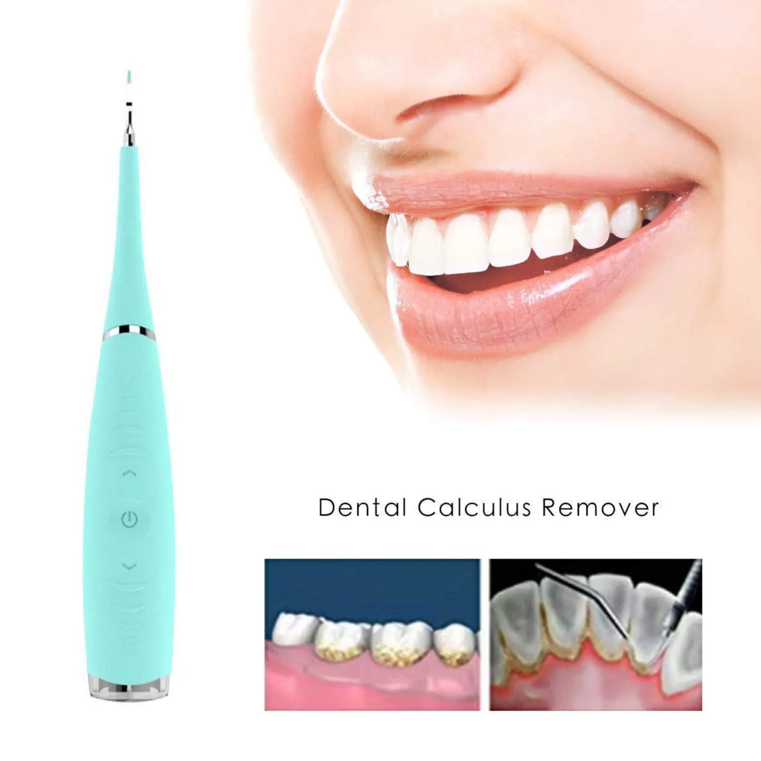 Portable Electric Sonic Dental Scaler Tooth Calculus Remover Tooth Stains Tartar Tool Dentist Whiten Teeth Health Hygiene white