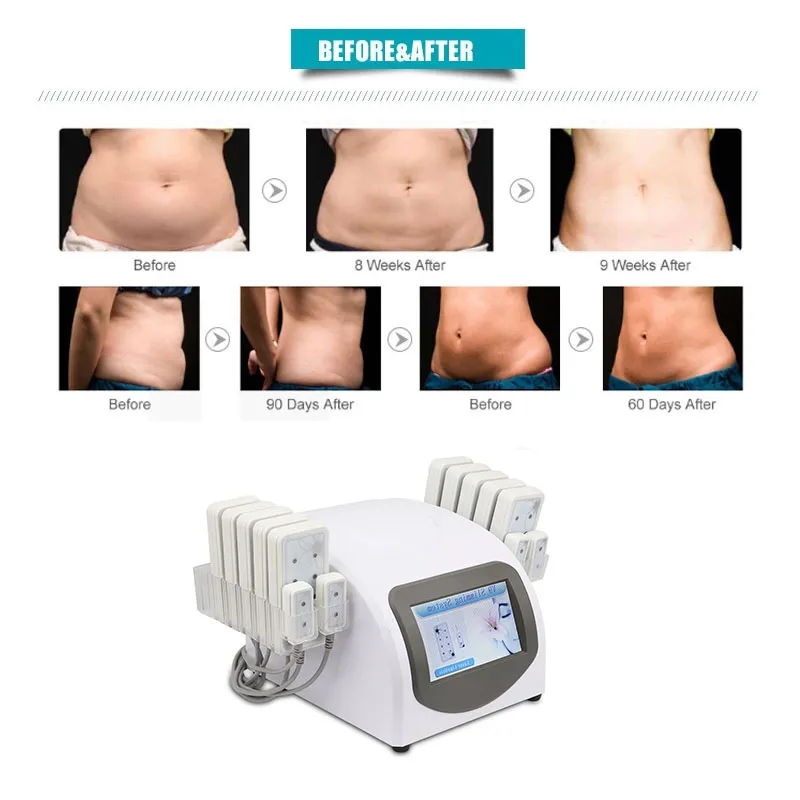 lipo laser slimming machine (2)