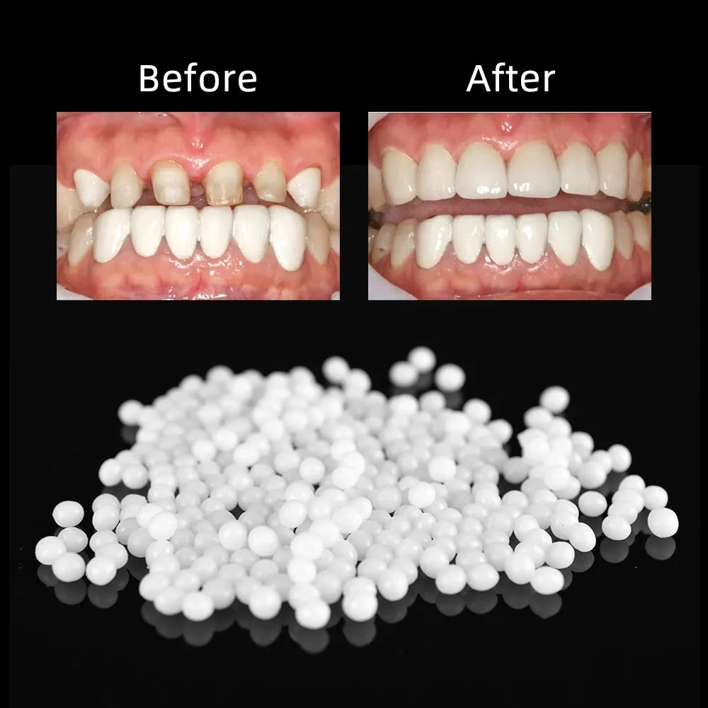 100g Faleteeth Katı tutkal geçici diş onarımı Set dişleri ve boşluk takma diş yapışkan dişleri diş hekimi reçinesi