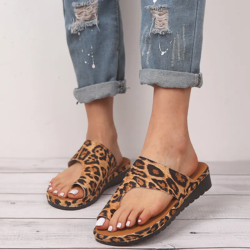Bunion