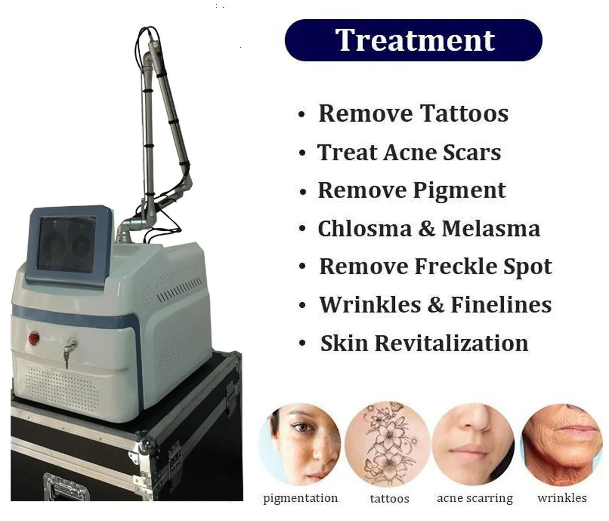 Rechtstreeks effect pico surelaser melasma verwijdering 532nm 755nm 1064nm 1320nm Pico tweede lasers verwijderen gezichtspigmentaire sproeten