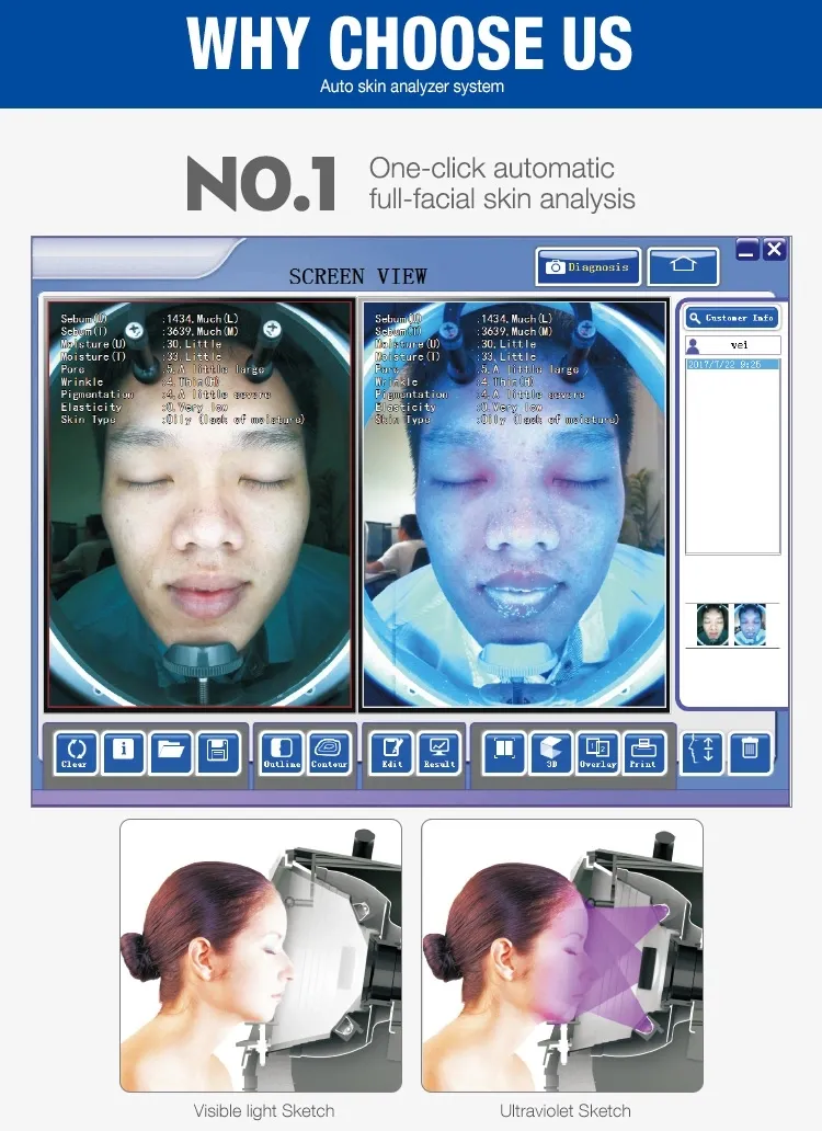 3d facial skin analyzer/face visia skin analysis machine