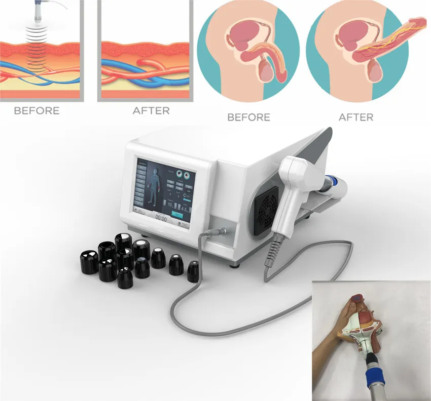 Fysisk Ed Shockwave PhytioTherapy Machine för erektil dysfunktion ESWT Shock Wave Therapy Fitness Tillbehör till smärtbehandling