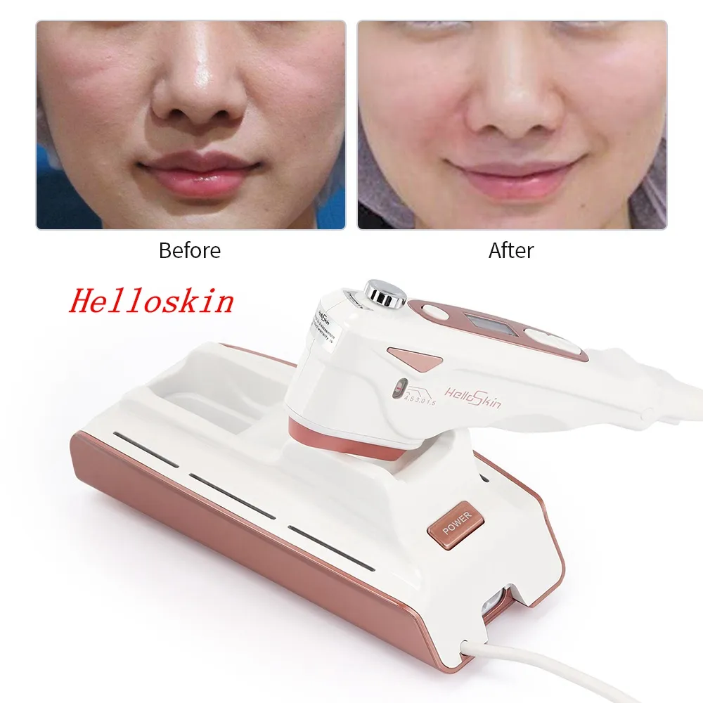 Portable Ultrasound Ultrasonic HIFU Machine Helloskin Face Lifting Skin Tighten Anti Ageing Wrinkle Removal Beauty Machine Home Salon Use