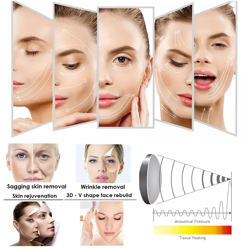 Nieuwste HIFU Machine Body Slimming 3D SMAS Geconcentreerde ultrasone witte schoonheid apparatuur voor gezicht opheffende huidverstrakking