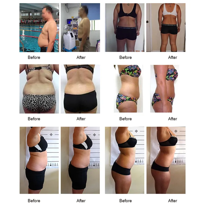 Lipo Laser 12 Pad 208 Diod Laser Slimming Skönhetsutrustning Lipo Laser Viktminskning Fettavlägsnande Fettbrännare