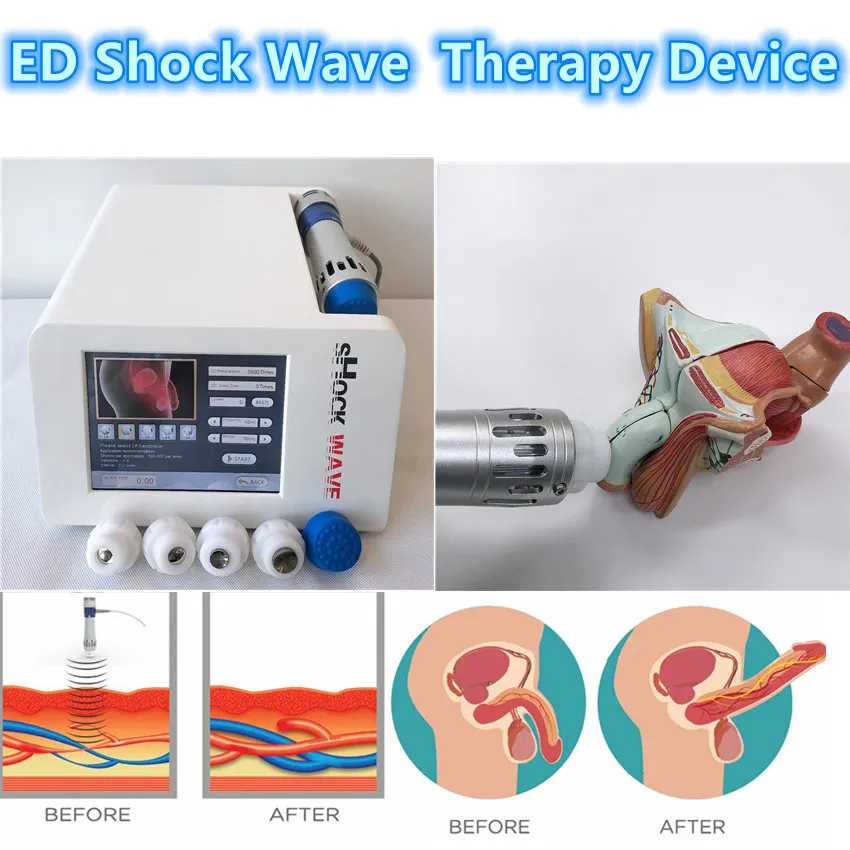 Portable Low Intensity Shockwave ED Therapy Device For Erectile