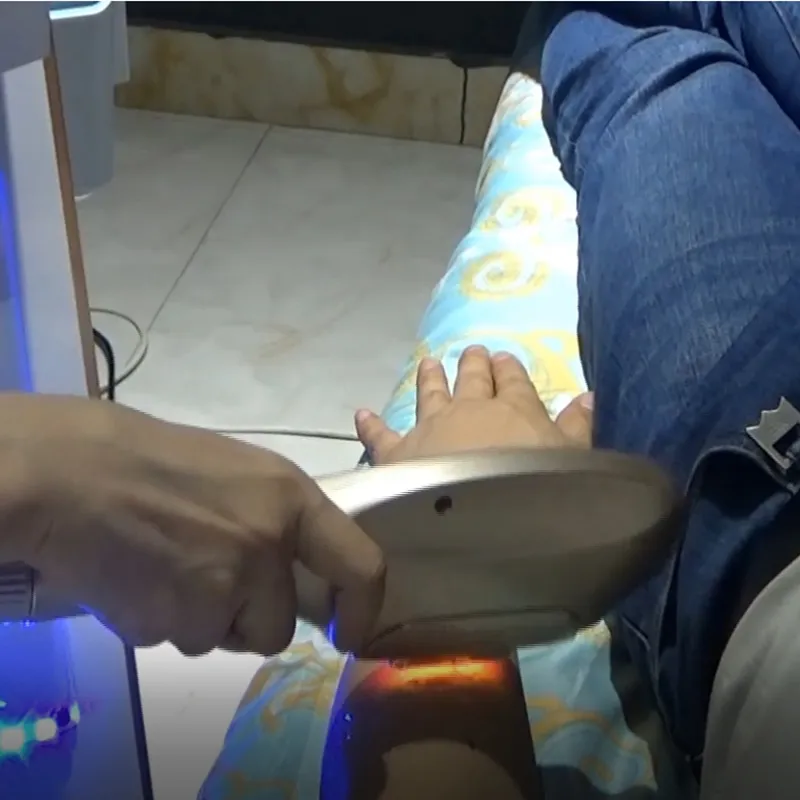 Acessórios opt Remoção de cabelo a laser Elight Skin Rejuventation para IPL Machine 600000 Tiro com os cabelos permanentes Remover HR SR