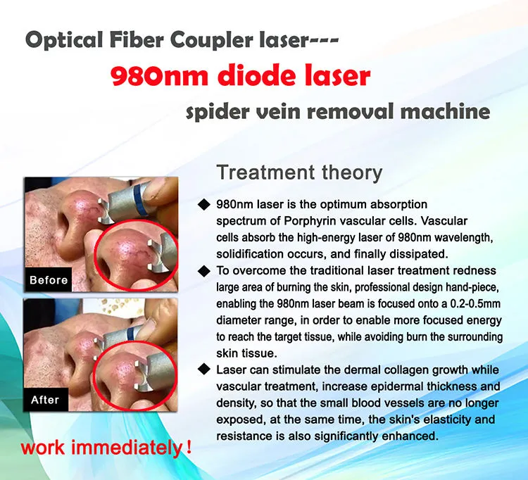 2020 Best Selling 980nm Diode Laser Spider Veins Blood Vessels Removal With CE