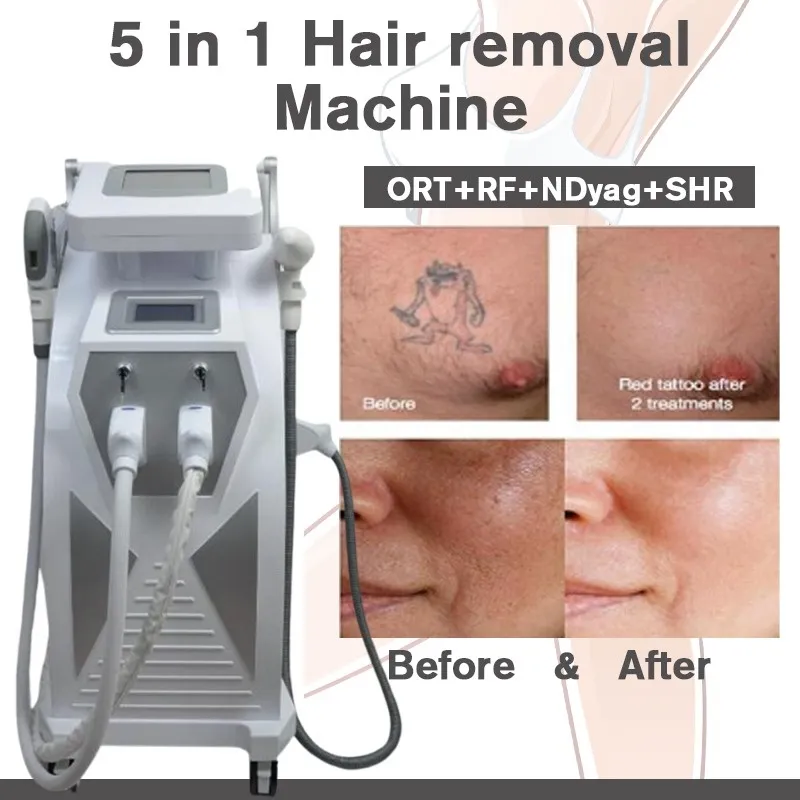 Laser E Light Machine HR Permanent Hårborttagning IPL Skin Care ND Yag Laser Tattoo Borttagning Dark Hud