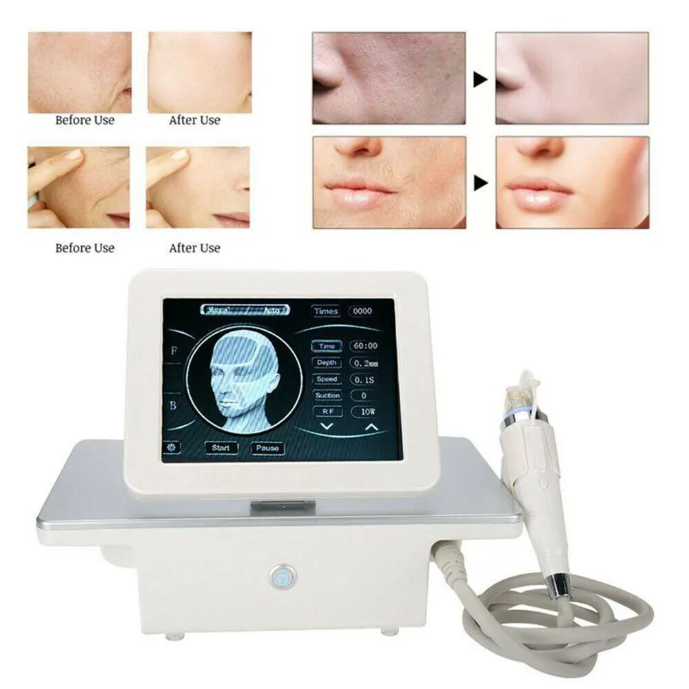 Máquina de radiofrecuencia fraccional de microagujas profesional 10/25/64/nano pines cartucho arrugas estrías eliminar la piel de la cara Lifting reducir los poros