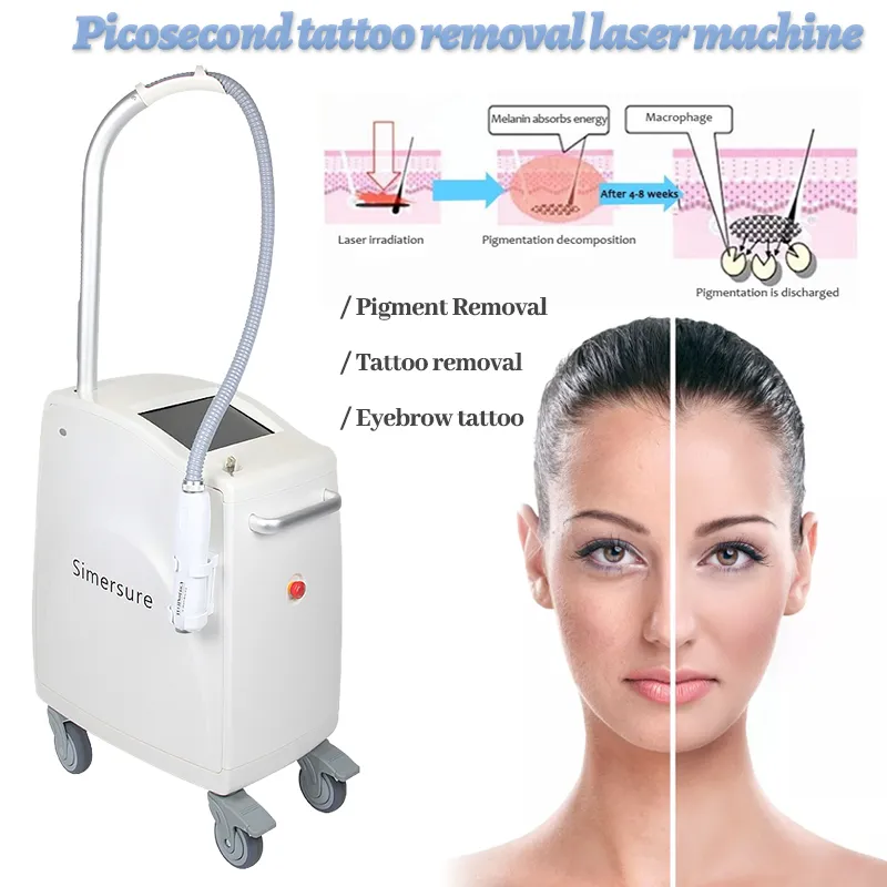 Laser Tattoo Removal Machine Washy Eyebrow Yag Lazer Pigment Wrinkle Ta bort skönhetsutrustning