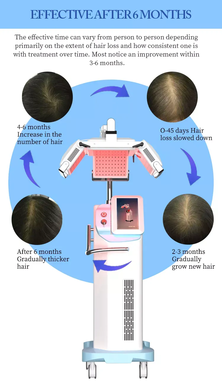 hair loss treatment machine led hair regrowth Effective 660NM diode laser hair regrowth anti-hair loss therapy latest machine Hair loss treatment 660nm diode laser hair regrowth machine - Honkay laser hair regrowth machine,laser hair growth device,hair regrowth machine,hair growth machine,hair regrowth