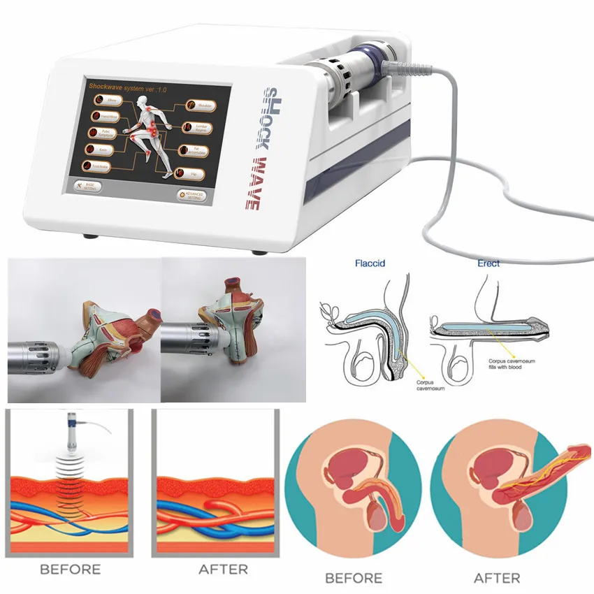 Máquina de onda de choque de baixa intensidade para tratamento de ED / fisioterapia Choque onda pênis Máquina de ampliador para terapia ED