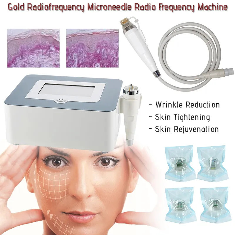 Microneedle RF Radio Frequency Skin Face Lift Stretch Wrinkle Removal