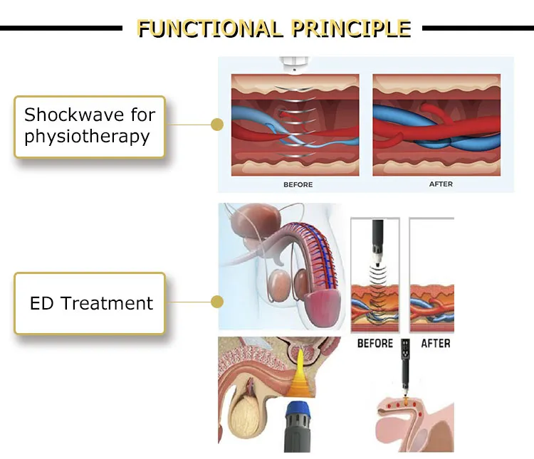 2021 popular portable electric penis massage therapy shockwave for ED