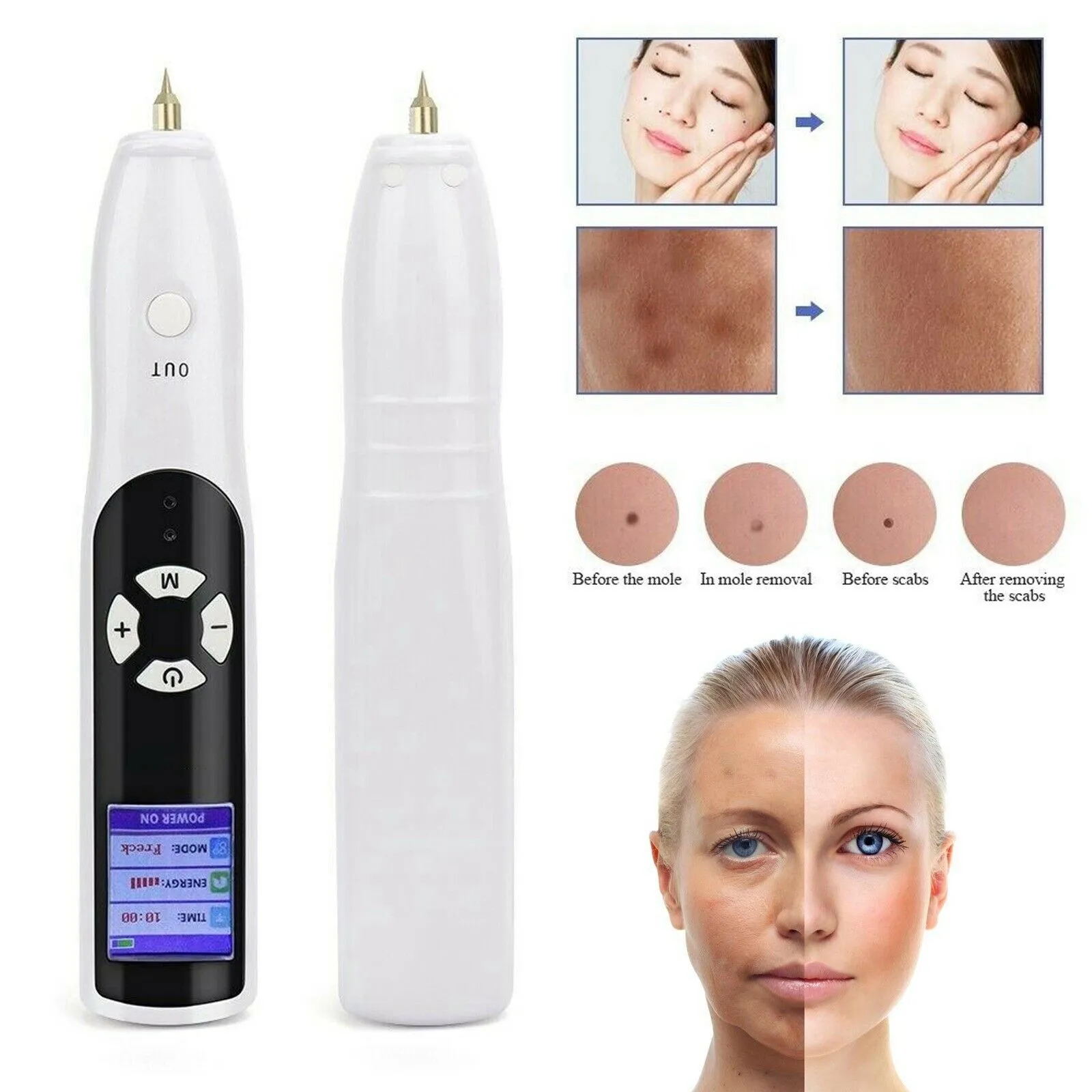 Nyaste Fibroblast Portable Plasma Pen Eyelide Lifting Plasmapen Anti Wrinkle Skin Care Dighting Spot Mole Remover Beauty Equipment DHL