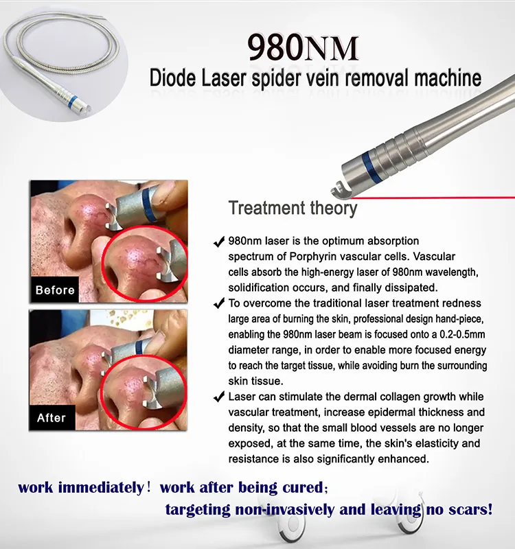 Professional 980nm Diode Laser f Facial Vascular Spider Vein Removal Machine DHL