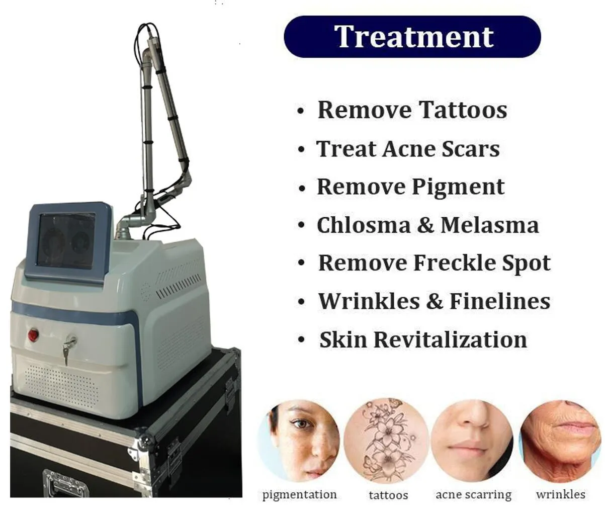 CE approval Picosecond Laser Melasma Removal 532nm 755nm 1064nm 1320nm Pico second Lasers remove facial pigmentary freckles