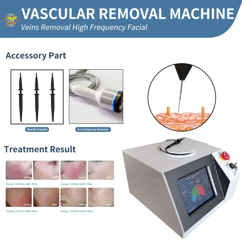 Laser Machine The RF High Frequency Vascular Removal Blood Vessel Spider Vein Removals