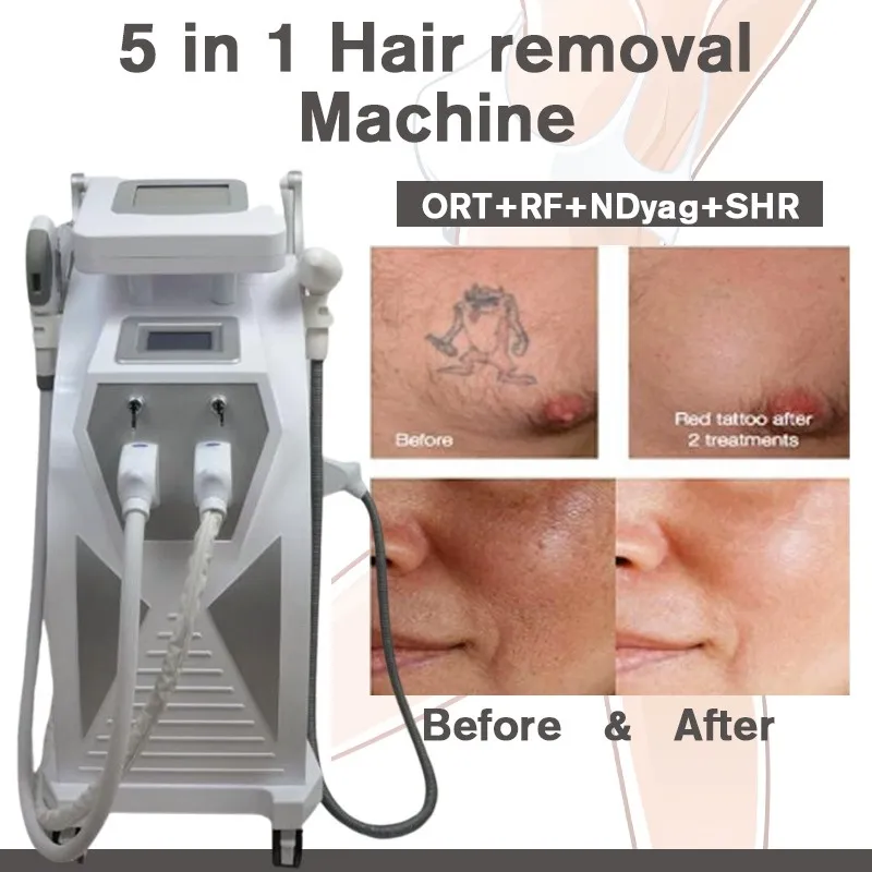 Professional Multifunction OPT HR IPL Laser Hair Removal ND YAG Laser Tattoo Removal Beauty Machine 5 In 1 IPL&RF&ND YAG&Elight CE/DHL