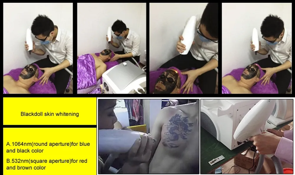 New products Laser Tattoo Removal / Blood Vessels Removal Machine