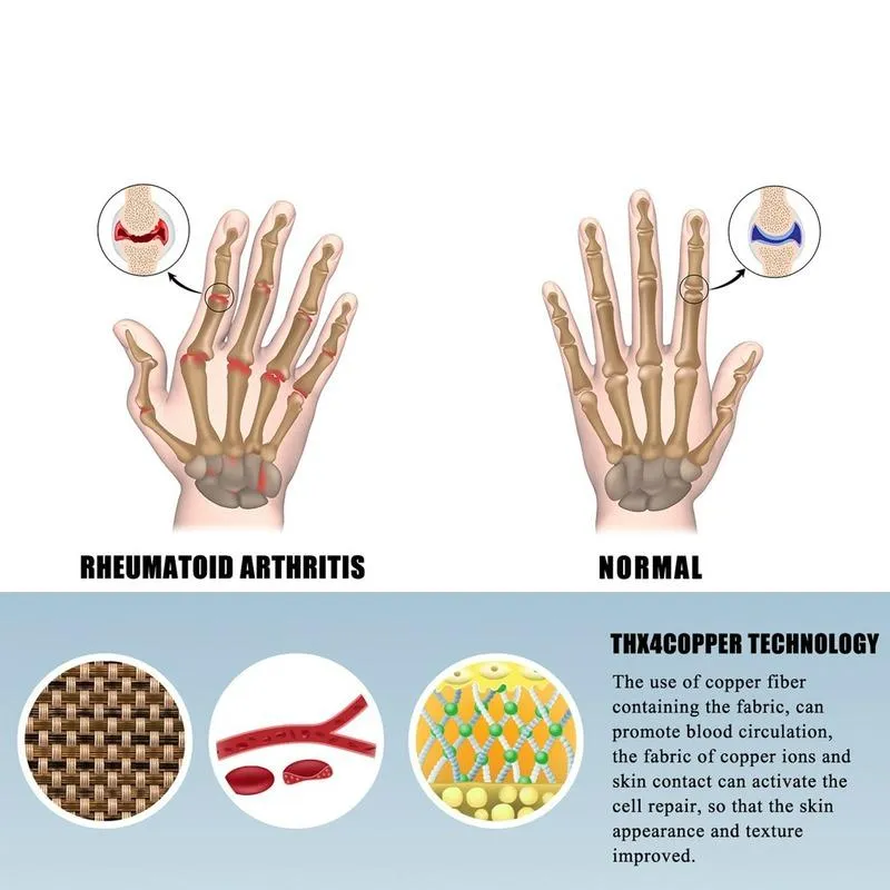Handledsstöd 1 par artrithandskar premium artritisk gemensam smärtlindring handterapi öppna fingrar290Z