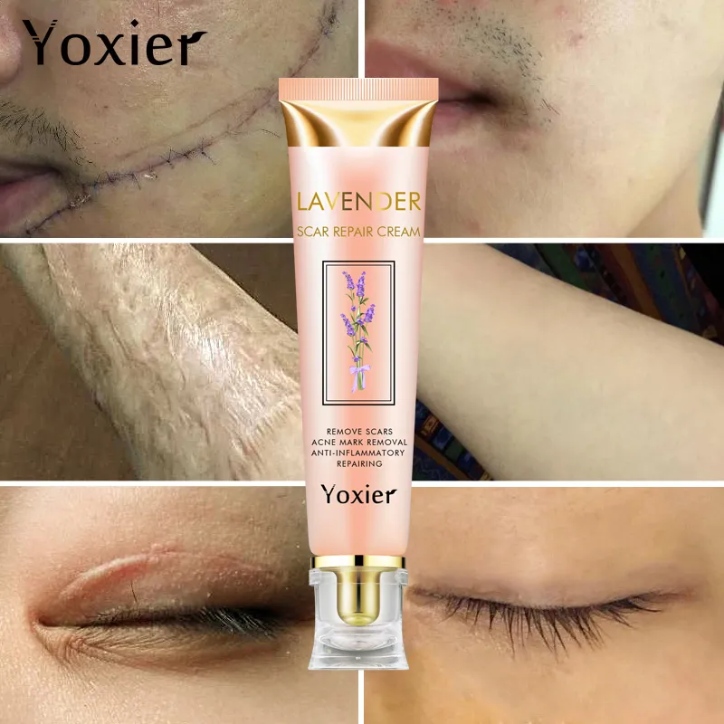 Yoxier Lavender Acne Scar Removal Cream Gel Face Pimples Stretch Marks Repairing Smoothing